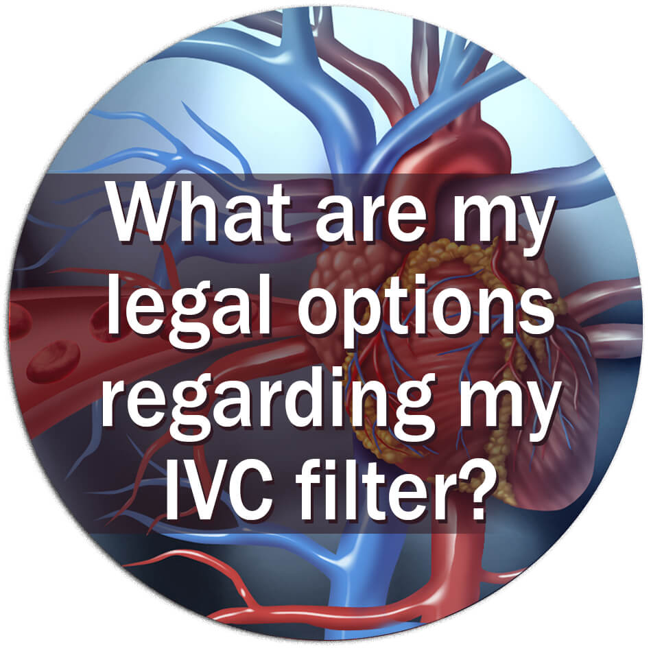 What are my legal options regarding my IVC filter?