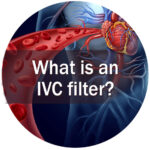 what is an IVC filter